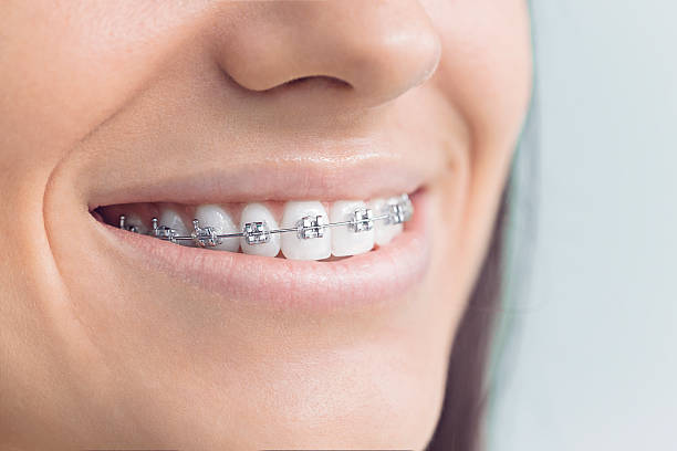 Best Veneers and Lumineers  in Jeannette, PA
